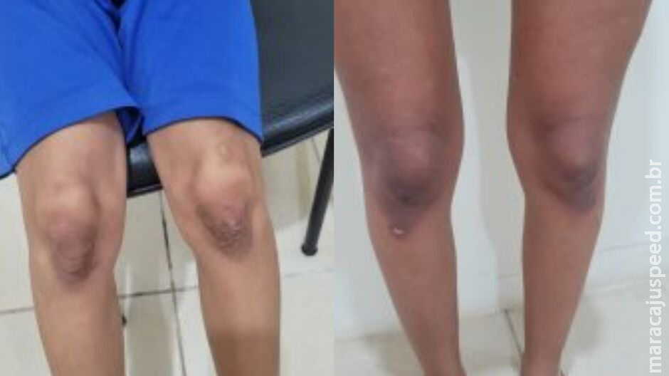 Duas mulheres são presas por torturarem adolescente e criança em Coxim