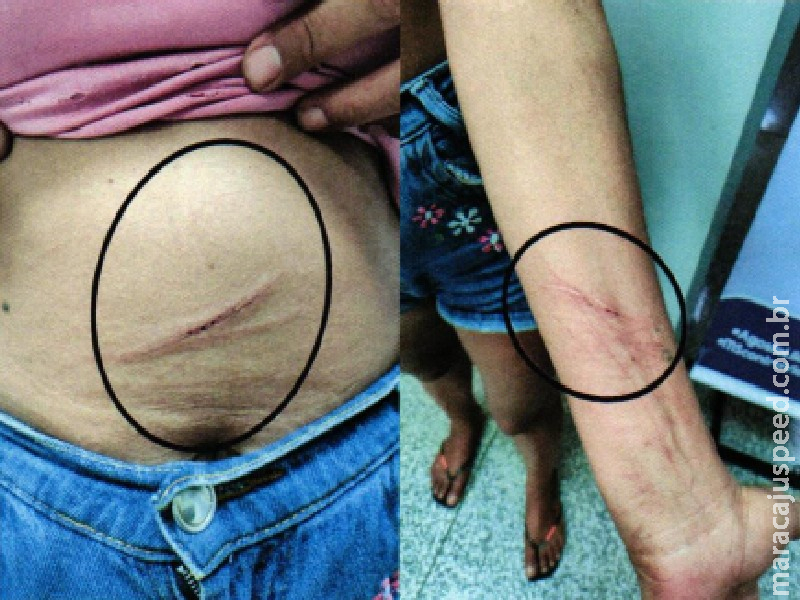 Ex pisoteou rosto de mulher e jogou terra com fezes na boca dela no Danúbio Azul Ex pisoteou rosto de mulher e jogou terra com fezes na boca dela no Danúbio Azul