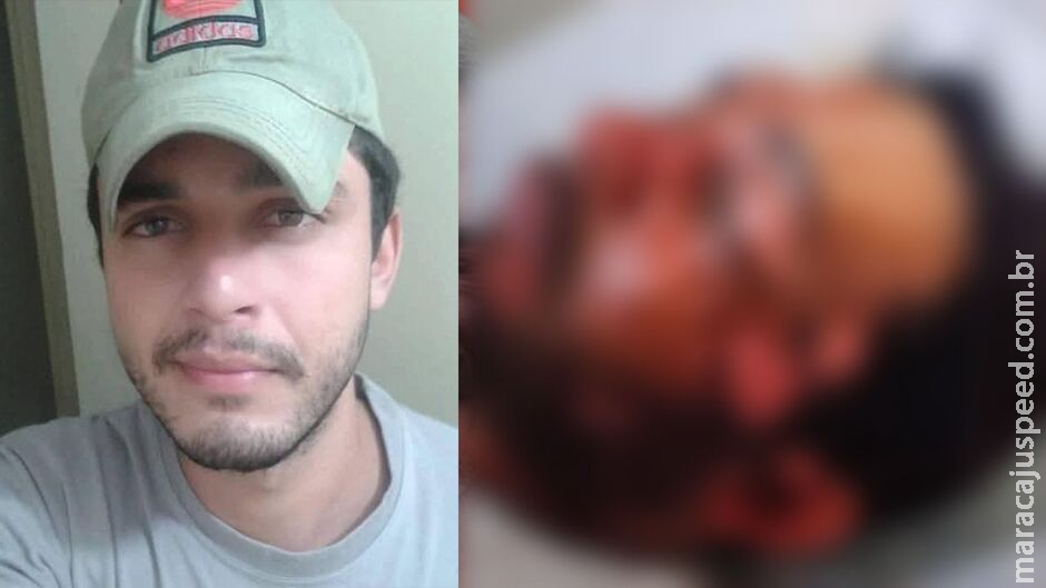 Homem atacado com água fervente pode perder a visão do olho direito Homem atacado com água fervente pode perder a visão do olho direito