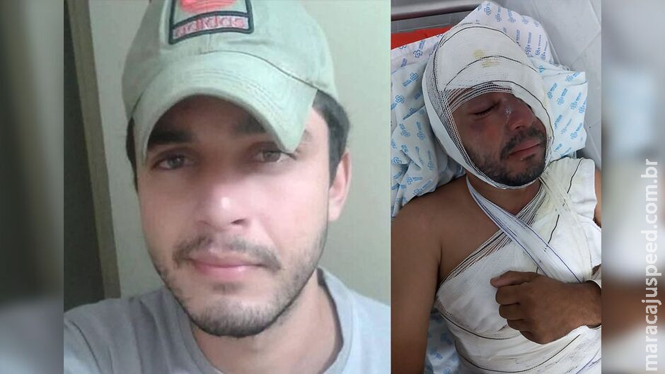 Homem atacado com água fervente recebe alta e fará tratamento para recuperar visão Homem atacado com água fervente recebe alta e fará tratamento para recuperar visão