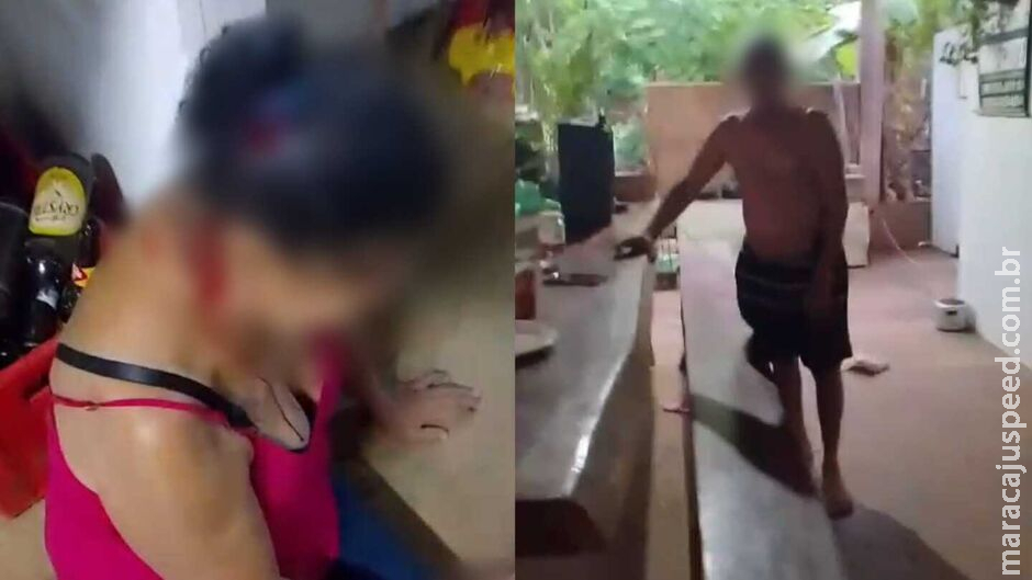 Marido bêbado agride mulher com paulada na cabeça em Terenos Marido bêbado agride mulher com paulada na cabeça em Terenos