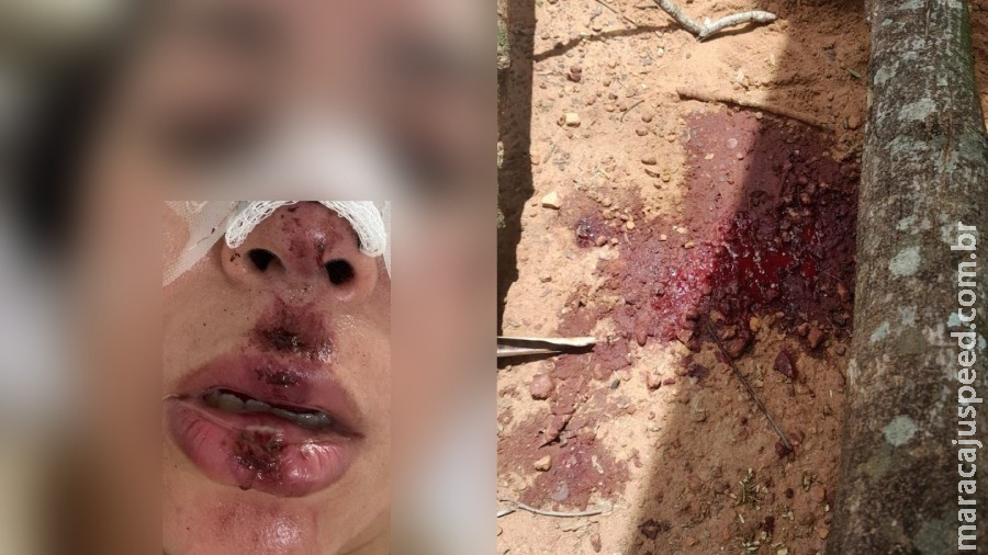 Mulher é atingida por árvore e fica gravemente ferida em Rio Verde de MT Mulher é atingida por árvore e fica gravemente ferida em Rio Verde de MT