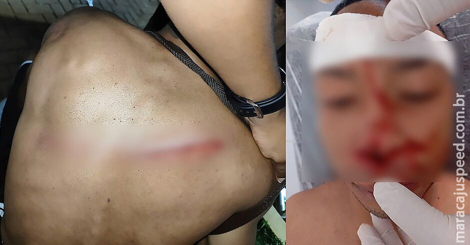 Corregedoria da PM vai investigar policial por agressão durante o Carnaval de Corumbá Corregedoria da PM vai investigar policial por agressão durante o Carnaval de Corumbá