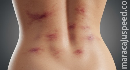 Em Sidrolândia, mulher vai cobrar pensão e acaba agredida com pranchadas de facão Em Sidrolândia, mulher vai cobrar pensão e acaba agredida com pranchadas de facão