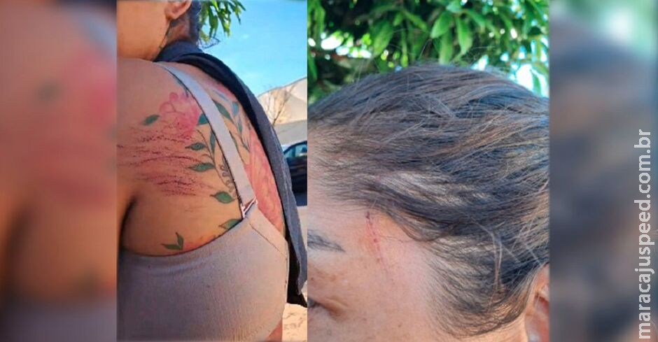 Garota de programa luta para provar estupro em condomínio de luxo de Campo Grande Garota de programa luta para provar estupro em condomínio de luxo de Campo Grande