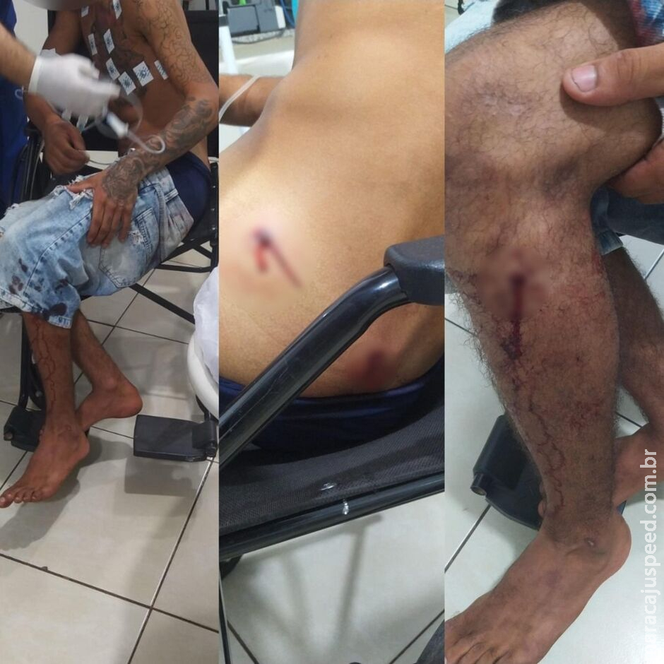 Jovem sofre tentativa de homicídio por homem encapuzado em Três Lagoas Jovem sofre tentativa de homicídio por homem encapuzado em Três Lagoas