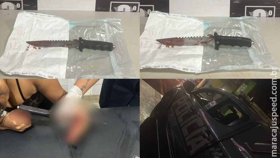 Mulher chega a hospital com faca cravada na mão após ataque de ex-marido Mulher chega a hospital com faca cravada na mão após ataque de ex-marido