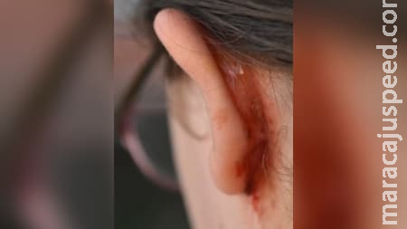 Mulher é agredida com cabeçada ao pegar o filho na casa do ex em Sidrolândia Mulher é agredida com cabeçada ao pegar o filho na casa do ex em Sidrolândia