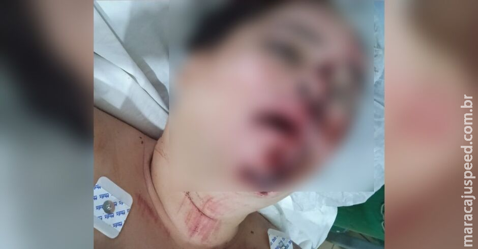 Mulher é espancada por três homens após festa em Ponta Porã Mulher é espancada por três homens após festa em Ponta Porã