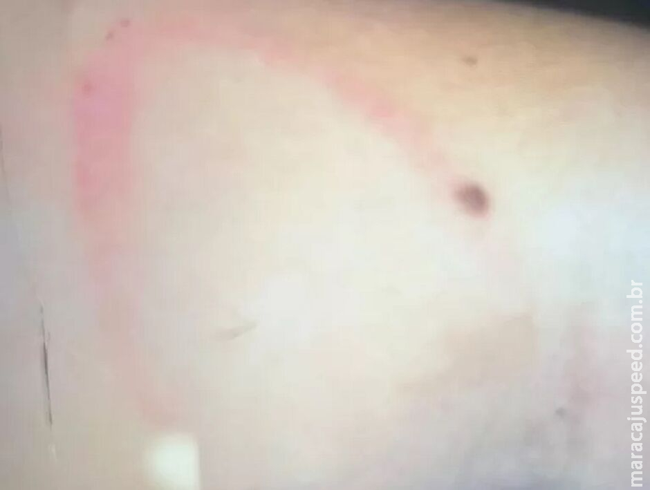 Mulher é presa por agredir a filha em Chapadão do Sul Mulher é presa por agredir a filha em Chapadão do Sul