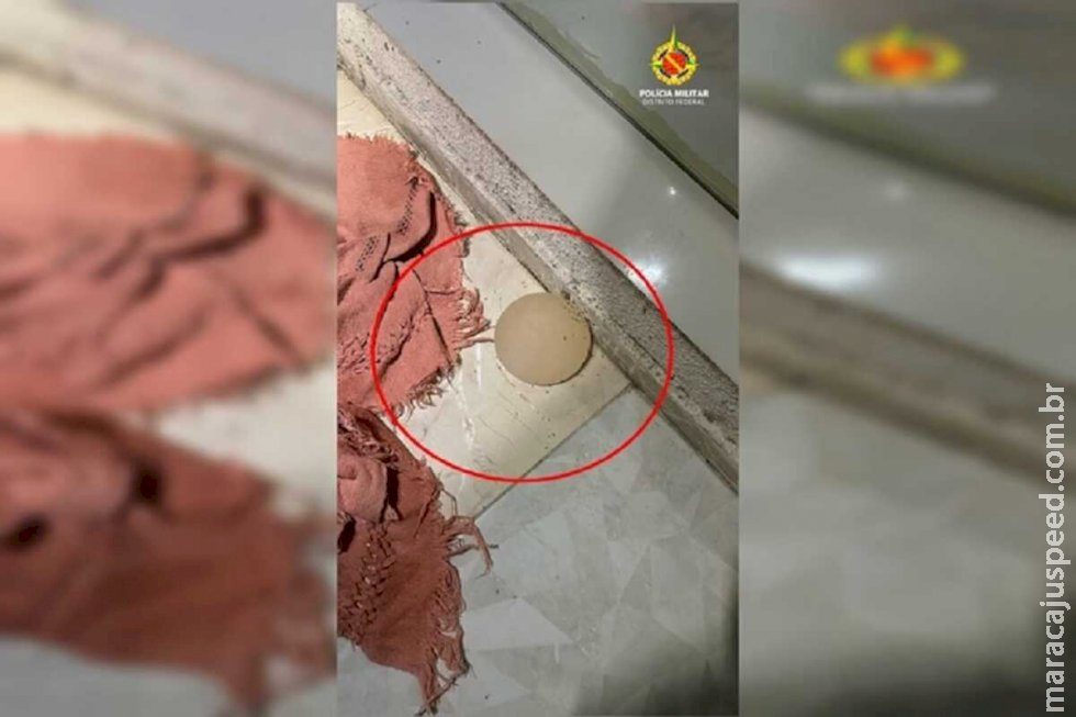 Mulher tem silicone tirado com faca de cozinha após brigar com marido Mulher tem silicone tirado com faca de cozinha após brigar com marido