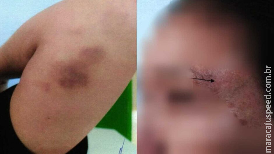 Padeiro controlava roupas, amizades e até uso do banheiro, diz esposa agredida Padeiro controlava roupas, amizades e até uso do banheiro, diz esposa agredida
