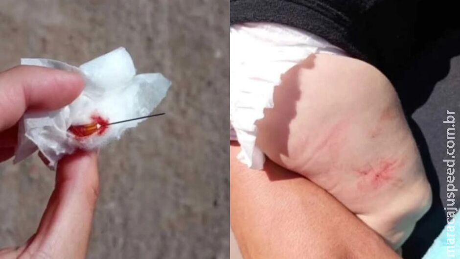 Bebê tem agulha Bebê tem agulha