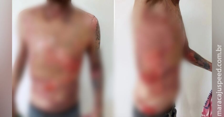 Mulher é presa após jogar água fervendo em vizinho enquanto ele dormia em Ivinhema Mulher é presa após jogar água fervendo em vizinho enquanto ele dormia em Ivinhema