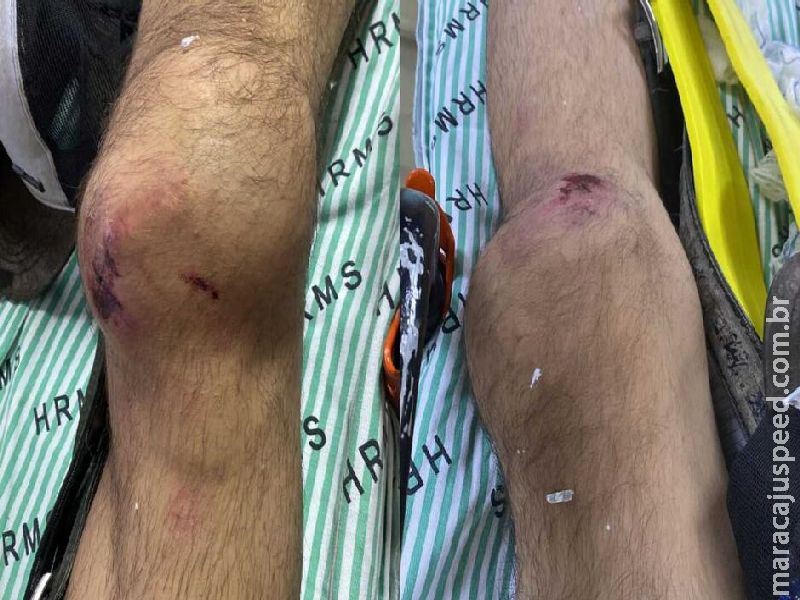 Cirurgia de trabalhador que caiu do telhado de igreja é adiada e família teme trombose Cirurgia de trabalhador que caiu do telhado de igreja é adiada e família teme trombose