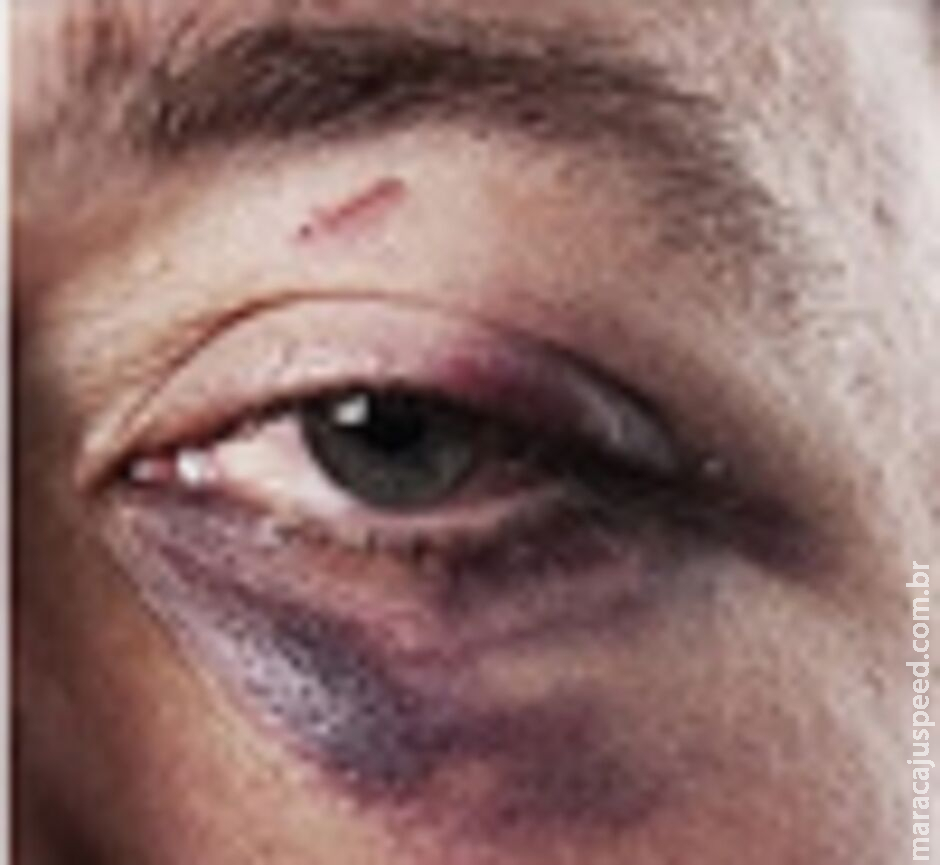 Homem é agredido pela companheira durante crise de ciúmes em bar de Campo Grande Homem é agredido pela companheira durante crise de ciúmes em bar de Campo Grande