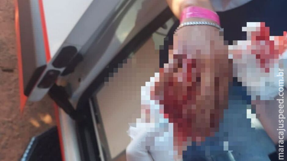 Jovem é socorrido com mão toda ensanguentada ao ser esfaqueado em Aquidauana Jovem é socorrido com mão toda ensanguentada ao ser esfaqueado em Aquidauana