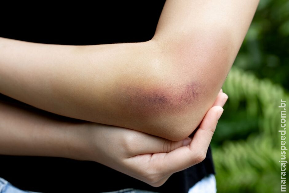 Mulher é agredida com cadeira pelo marido em Dourados Mulher é agredida com cadeira pelo marido em Dourados