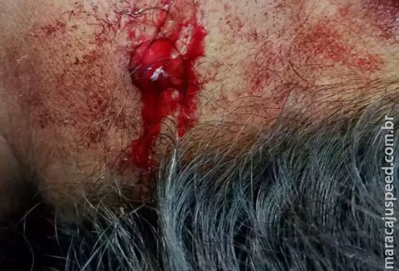Mulher é baleada de raspão durante perseguição policial em Coxim Mulher é baleada de raspão durante perseguição policial em Coxim