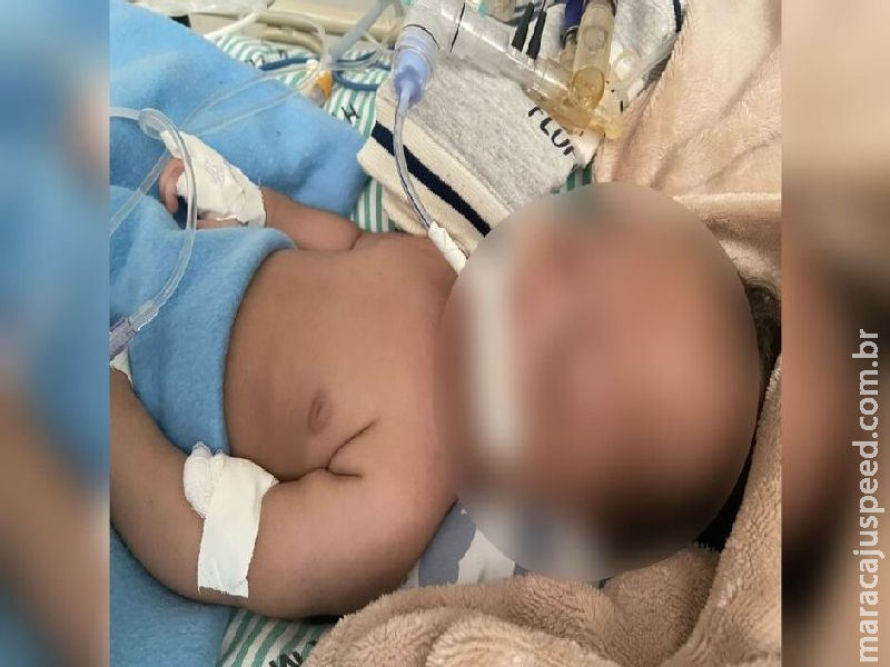 Exames devem indicar se bebê com lesões e sangramento sofreu maus-tratos em Terenos Exames devem indicar se bebê com lesões e sangramento sofreu maus-tratos em Terenos