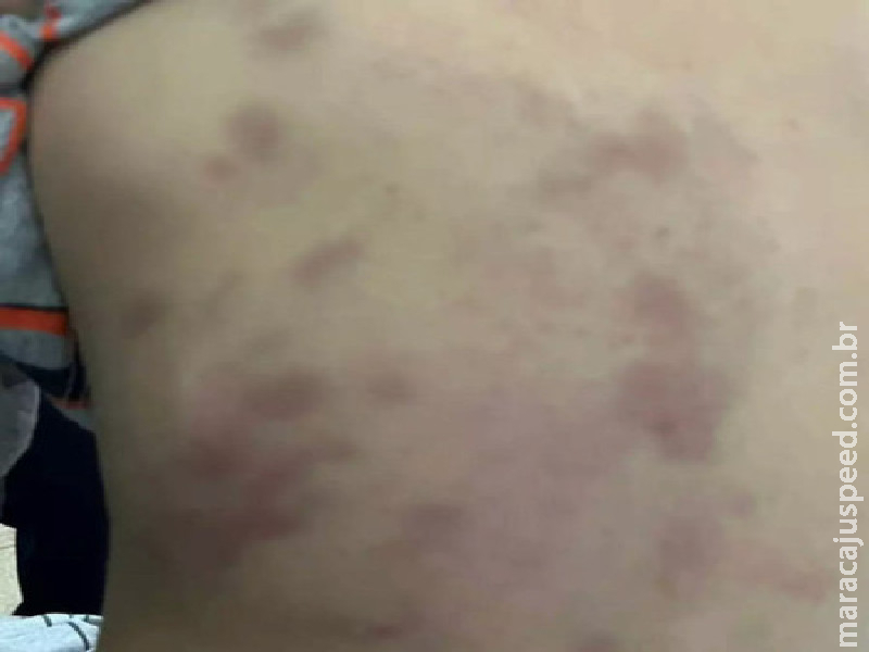 Homem é preso por espancar enteado de 3 anos em Dourados Homem é preso por espancar enteado de 3 anos em Dourados
