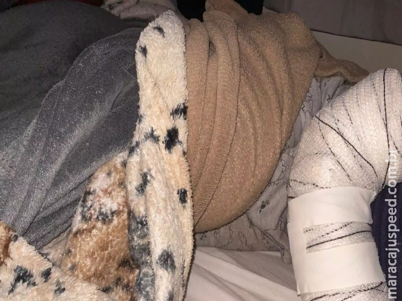 Mãe denuncia creche após filho ter o braço deslocado ao cair em solário