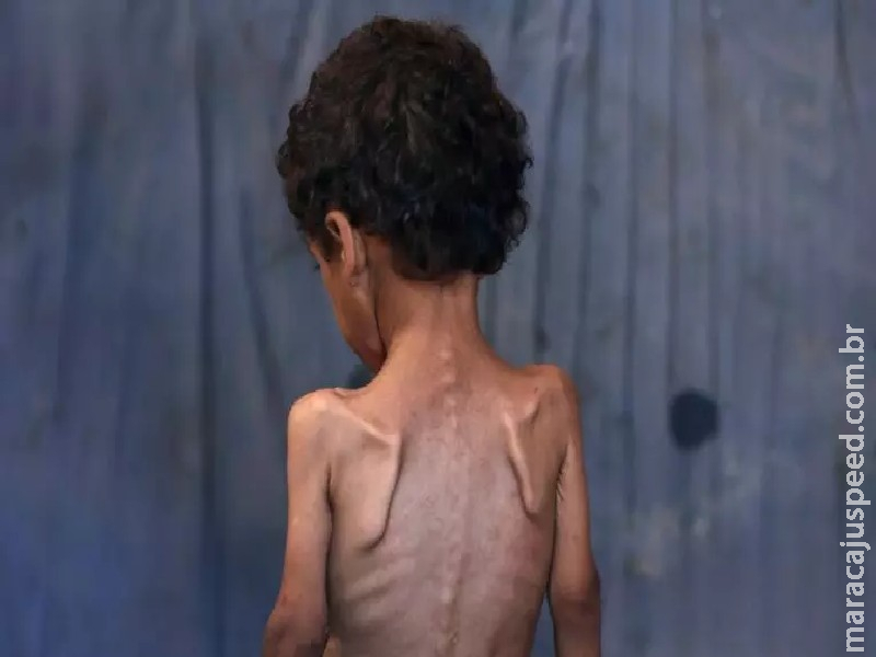Mais 9 pessoas morrem de fome em Gaza e Israel promete liberar entrega de ajuda por via aérea
