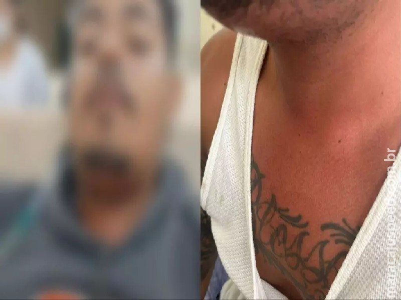 Paciente aguarda vaga em hospital de Campo Grande após sofrer complicações de extração do siso Paciente aguarda vaga em hospital de Campo Grande após sofrer complicações de extração do siso