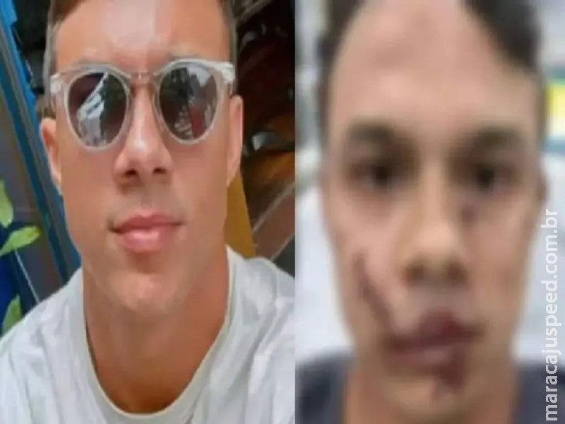 Personal trainer leva 45 pontos no rosto após ser agredido ao defender vítimas de assédio Personal trainer leva 45 pontos no rosto após ser agredido ao defender vítimas de assédio