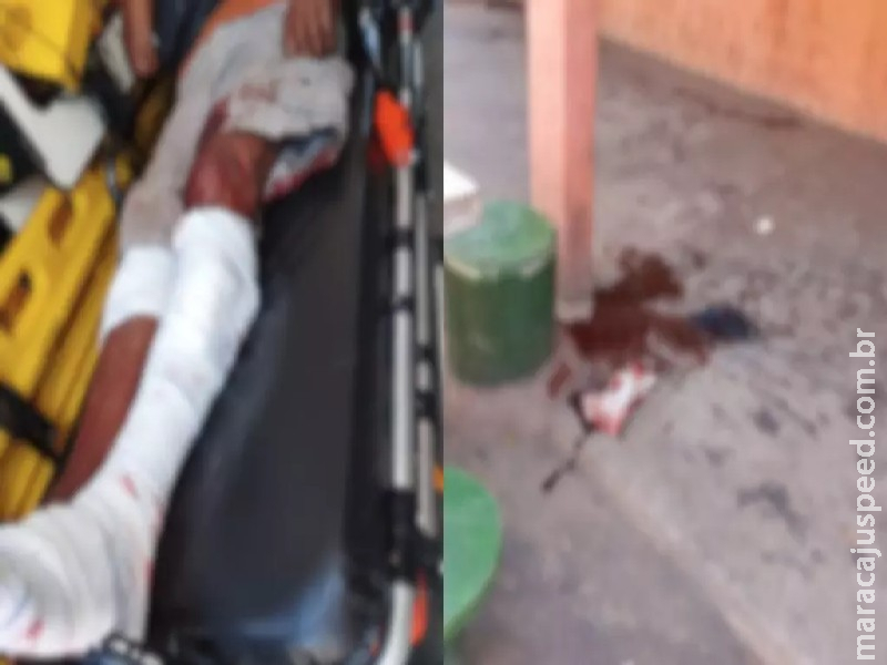 Após ataque de cães, homem sofre laceração na panturrilha em Corumbá