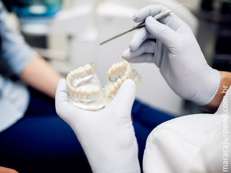 Associação vai selecionar pacientes para receberem implante dentário Associação vai selecionar pacientes para receberem implante dentário