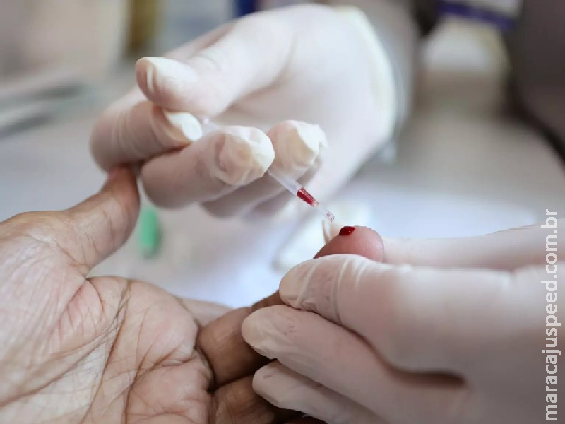 Casos de hepatite A caem em Campo Grande, mas vacinação segue abaixo da meta Casos de hepatite A caem em Campo Grande, mas vacinação segue abaixo da meta