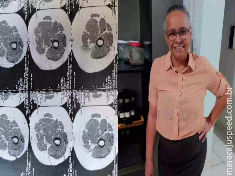 Câncer volta após cirurgia e filha organiza nova feijoada e rifa para custear tratamento da mãe