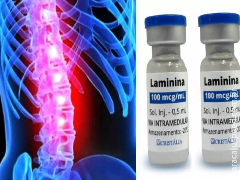Polilaminina: nova fase de tratamento inédito terá teste em SP