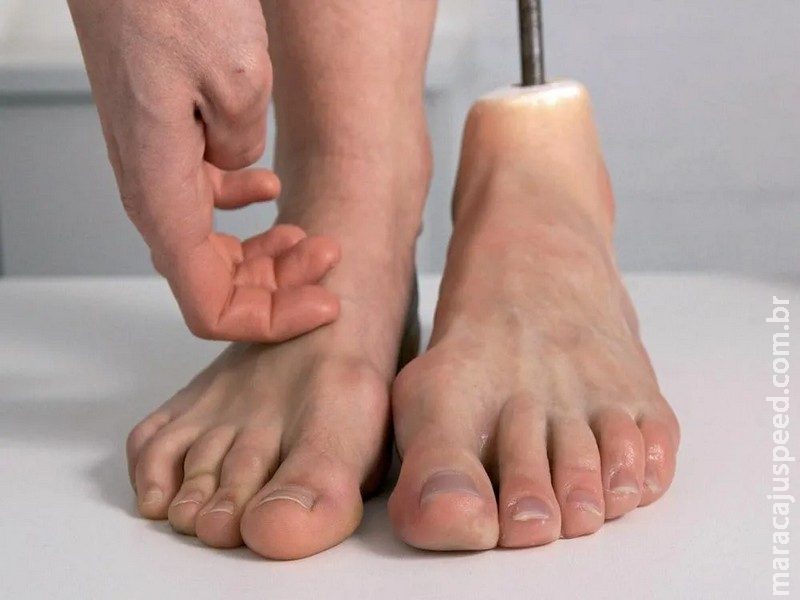 Homem tem pé amputado e decide cozinhá-lo para amigos: “Todo mundo provou”