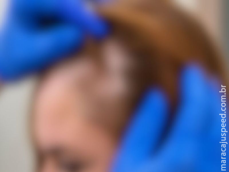 Empresa de cosméticos terá que indenizar consumidora que sofreu queimaduras  