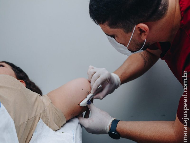 Contraceptivo altamente eficaz, Implanon é ofertado em 70 municípios de Mato Grosso do Sul