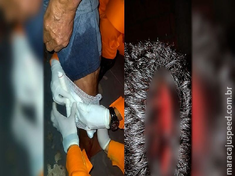 Idoso é atacado por Pitbull e sofre ferimentos graves na cabeça e perna em Corumbá 