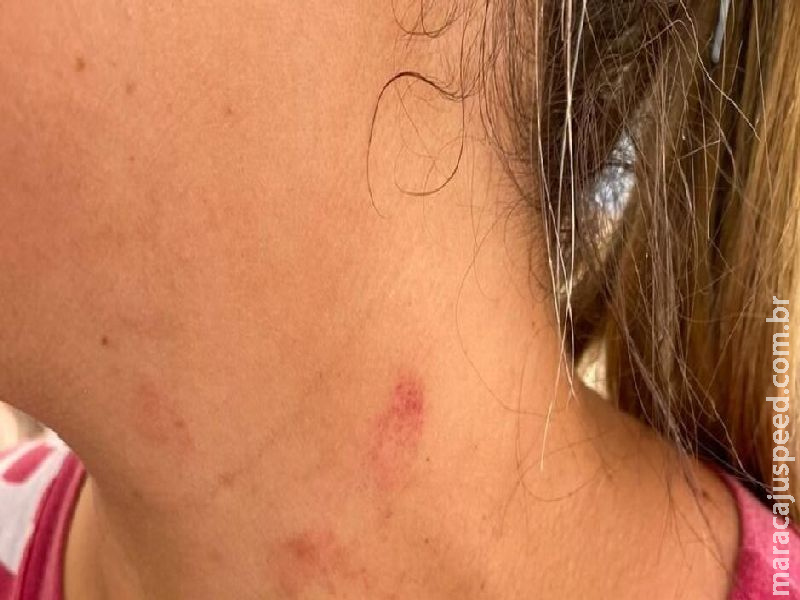 Mãe é jogada no chão, leva chutes e socos e denuncia agressão da filha em Dourados  