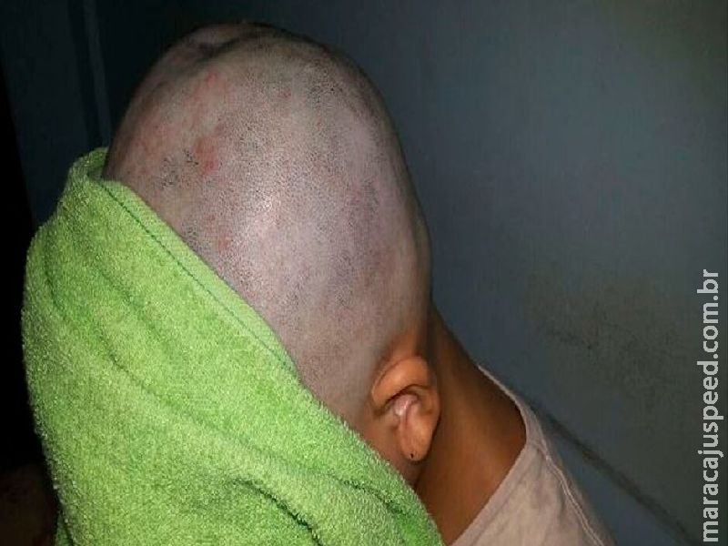 Mulher é agredida e tem cabelos cortados com faca pelo marido em fazenda de MS  