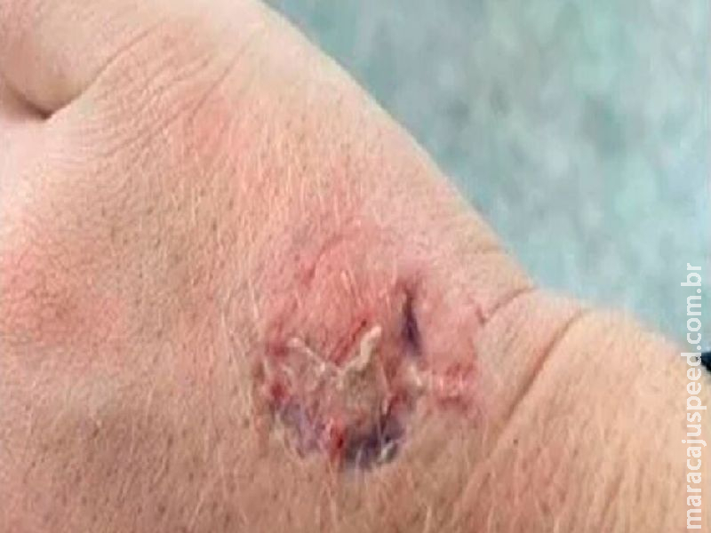 Mulher fica fora de controle, passa amaciante nas partes íntimas e morde policial em shopping  