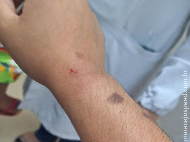 Adolescente é atacada por cachorro da própria família em Corumbá