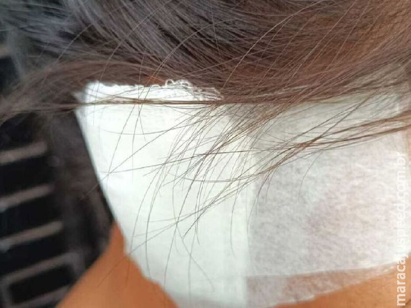 Adolescente tem orelha mordida e pede socorro em supermercado no Jardim dos Estados 