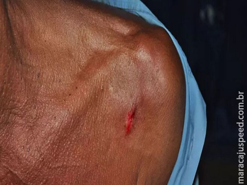 Jovem agride o próprio pai por causa de senha de Wi-Fi no Lageado