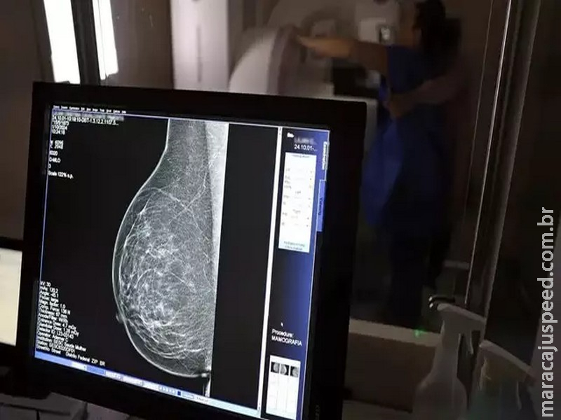 Justiça autoriza que detenta deixe presídio para investigar câncer de mama