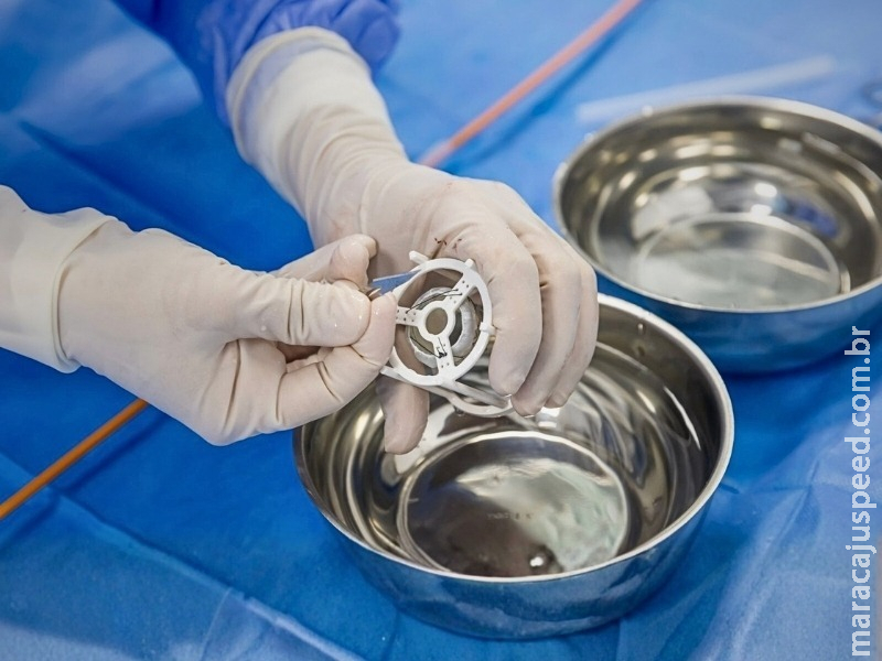 MPMS investiga operadora de plano de saúde por punição indevida a médicos que indicaram procedimento