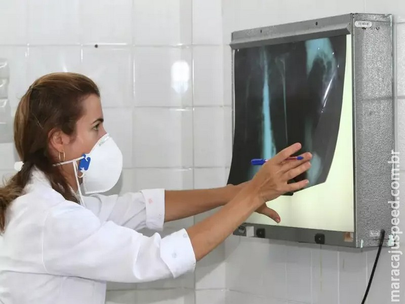 OMS recomenda testes de diagnóstico rápido para erradicar tuberculose