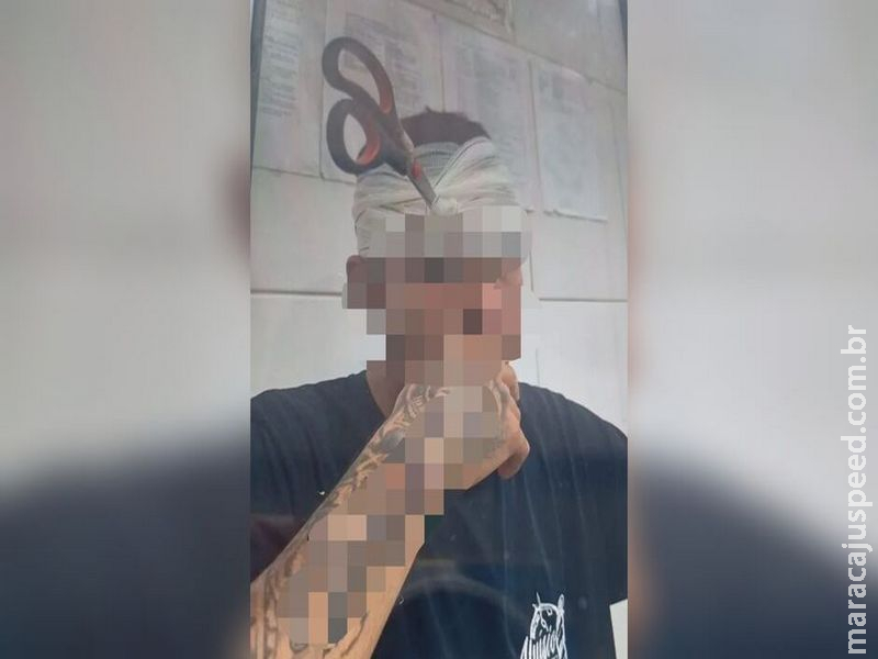 Rapaz fica com tesoura cravada na cabeça durante 