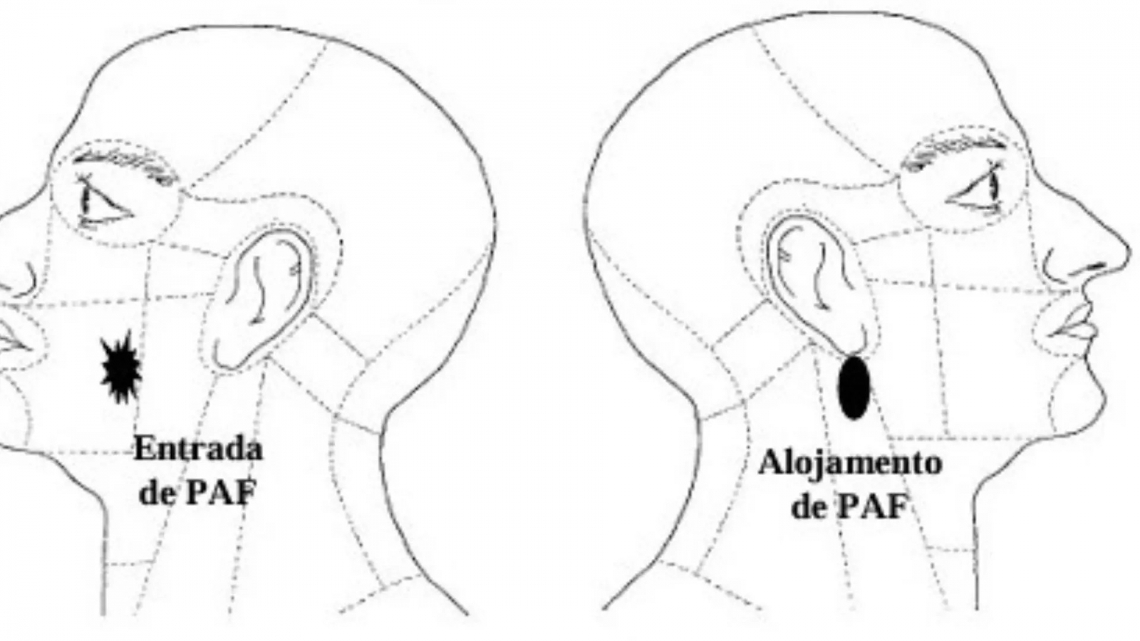 Tiro pela frente: laudo contradiz versão da família sobre morte em ocorrência da PM