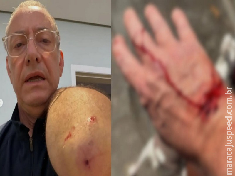 Jornalista da Globo é atacado por pit bull e é hospitalizado em São Paulo